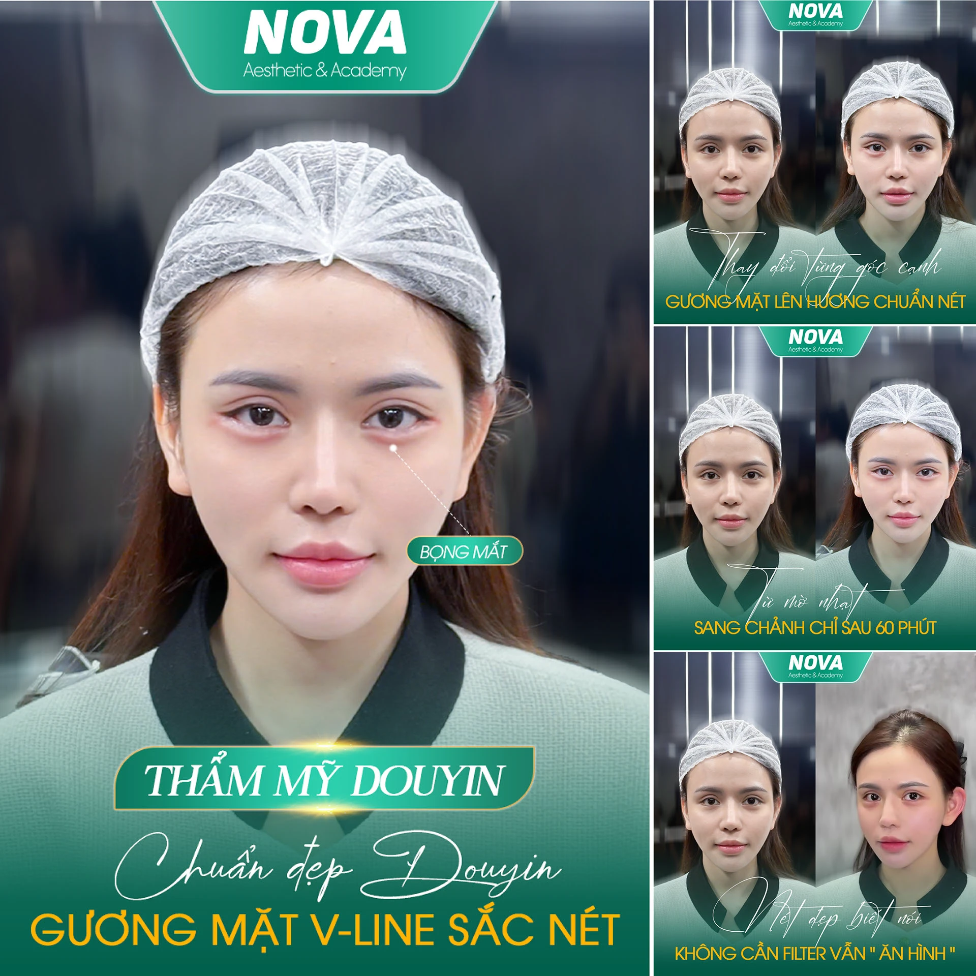 421edd225238587.685bb83851eeb