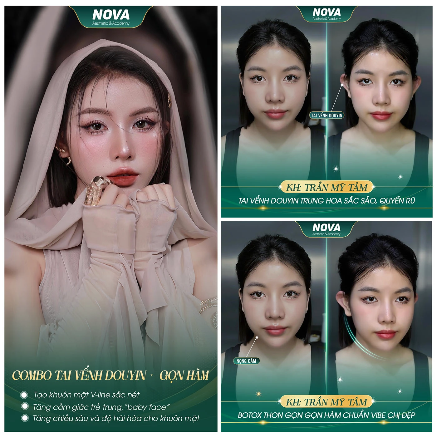 44cb59225238587.682b03440d116