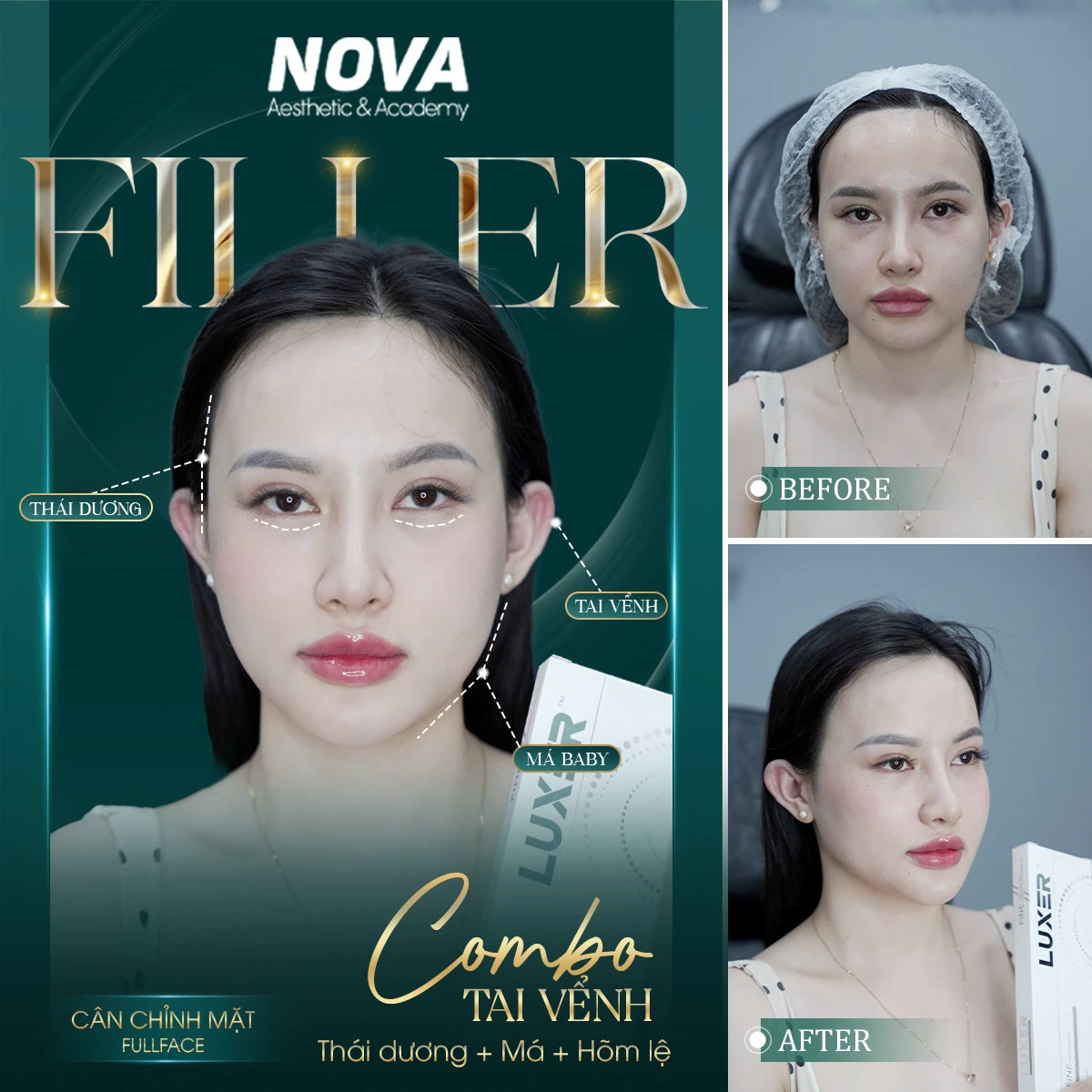 7e9e7f225238587.6819e47bc97c8