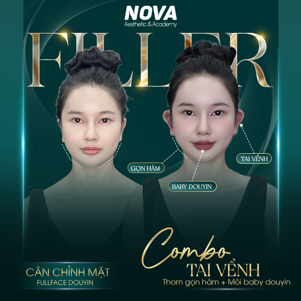 b37cc1225238587.6819e47bca4cb